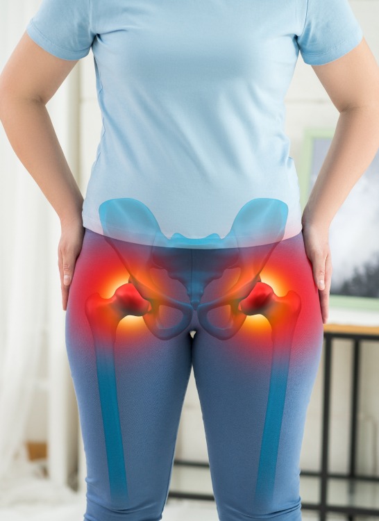 Patient with hip pain and inflammation in both hip joints, showing symptoms before Siddha therapy and rehabilitation